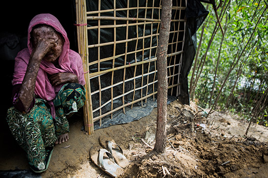 Rohingya_woman_burned.jpg