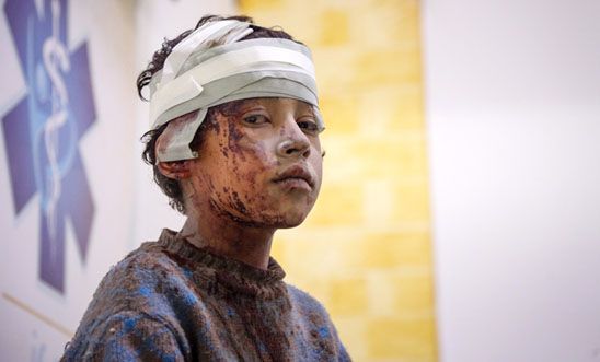 A wounded Syrian child at a field hospital in Eastern Ghouta
