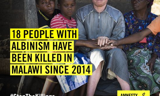 18 people with albinism have been killed in Malawi since 2014