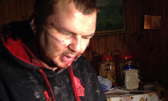 Ukraine protestor Dmitrii Bulatov was abducted and tortured Ukraine protestor Dmitrii Bulatov was abducted and tortured